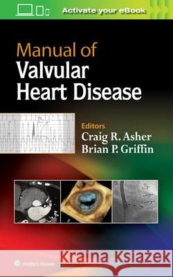 Manual of Valvular Heart Disease Craig R. Asher Brian P. Griffin 9781496310125 LWW - książka