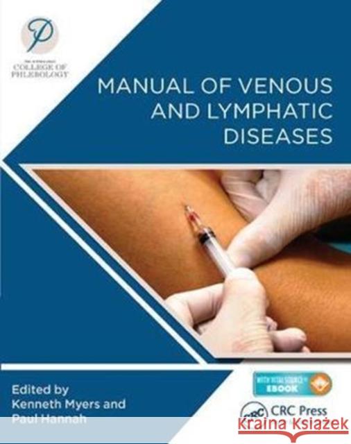 Manual of Venous and Lymphatic Diseases: The Australasian College of Phlebology Myers, Ken 9781138036765 CRC Press - książka