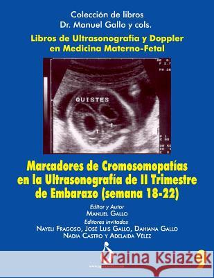 Marcadores Cromosomopatías En La Ultrasonografia de II Trimestre de Embarazo (Semana 18-22) Gallo, Manuel 9781731482662 Independently Published - książka