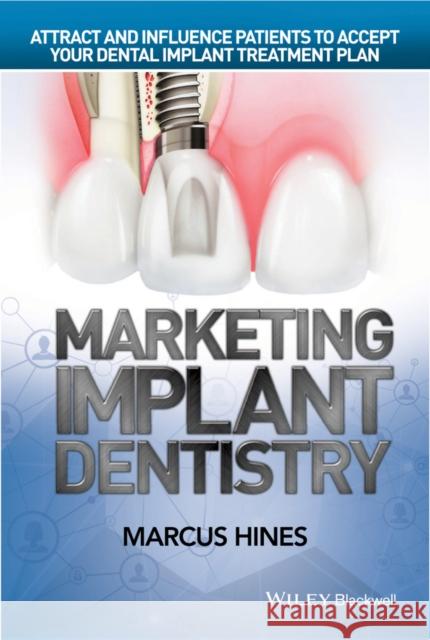 Marketing Implant Dentistry: Attract and Influence Patients to Accept Your Dental Implant Treatment Plan Hines, Marcus 9781119114512 Wiley-Blackwell - książka
