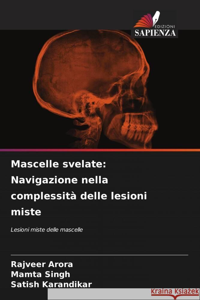 Mascelle svelate: Navigazione nella complessit? delle lesioni miste Rajveer Arora Mamta Singh Satish Karandikar 9786208152185 Edizioni Sapienza - książka