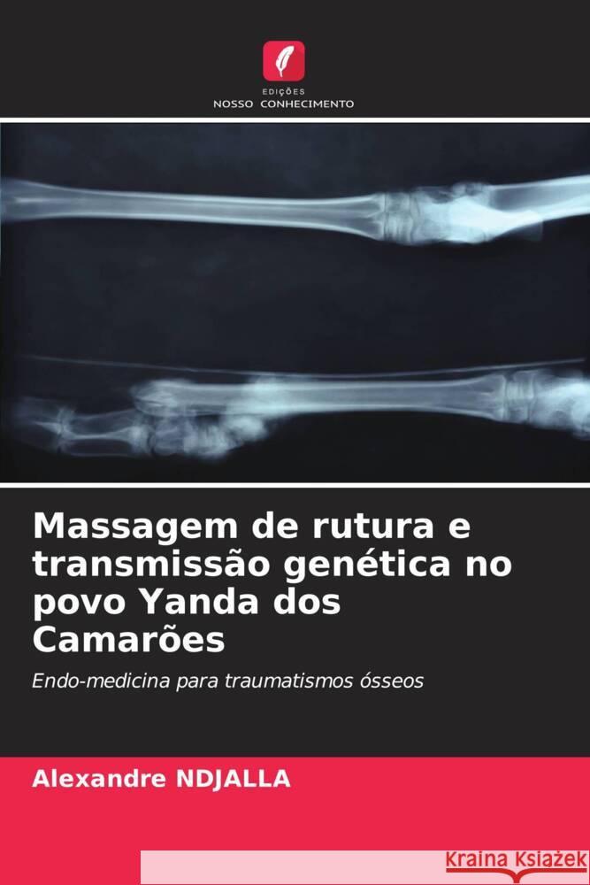 Massagem de rutura e transmiss?o gen?tica no povo Yanda dos Camar?es Alexandre Ndjalla 9786206907343 Edicoes Nosso Conhecimento - książka