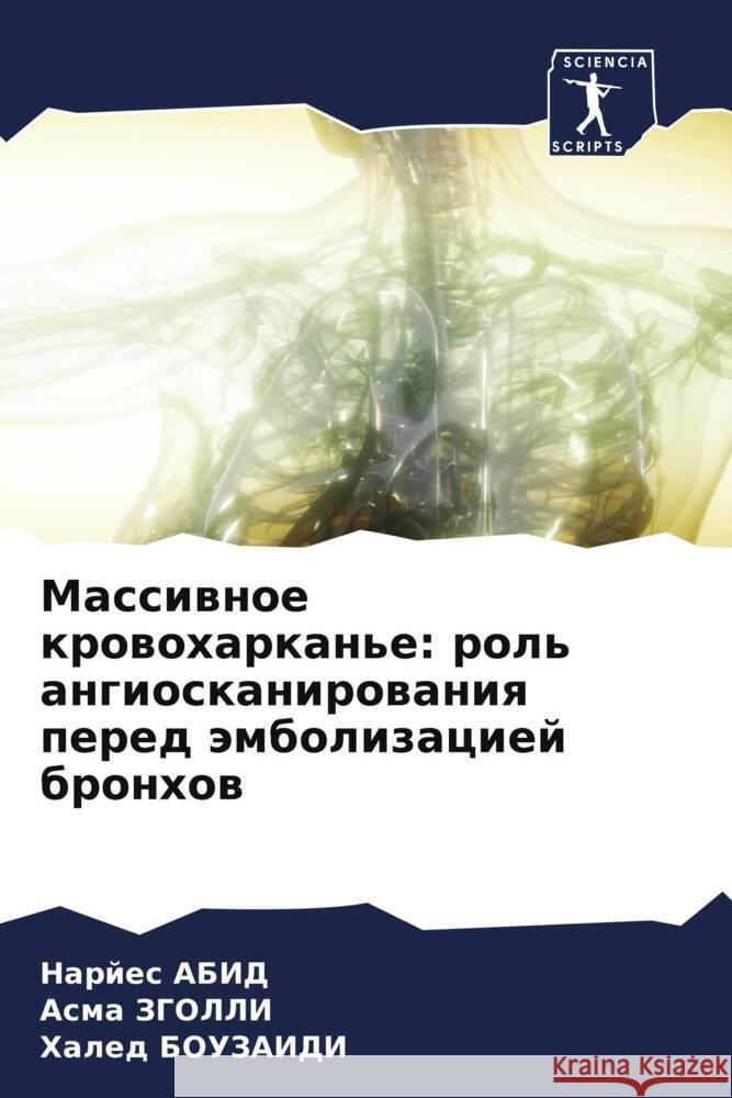 Massiwnoe krowoharkan'e: rol' angioskanirowaniq pered ämbolizaciej bronhow Abid, Narjes, Zgolli, Asma, BOUZAIDI, Haled 9786208243005 Sciencia Scripts - książka