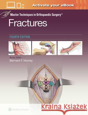 Master Techniques in Orthopaedic Surgery: Fractures Michael J. Gardner 9781975139407 Wolters Kluwer Health - książka