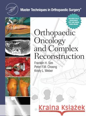 Master Techniques in Orthopaedic Surgery: Orthopaedic Oncology and Complex Reconstruction Frankln Sim 9781608310432 LIPPINCOTT WILLIAMS & WILKINS - książka