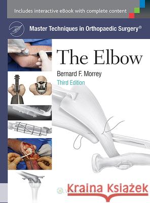 Master Techniques in Orthopaedic Surgery: The Elbow Bernard F. Morrey 9781451173093 Lippincott Williams & Wilkins - książka