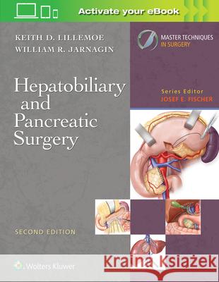 Master Techniques in Surgery: Hepatobiliary and Pancreatic Surgery Keith D. Lillemoe 9781496385574 LWW - książka