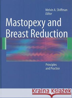 Mastopexy and Breast Reduction: Principles and Practice Shiffman, Melvin a. 9783540898726 Springer - książka