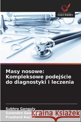 Masy nosowe: Kompleksowe podejscie do diagnostyki i leczenia Ganguly, Subhro, Gawarle, Surendra, Keche, Prashant 9786203920901 Wydawnictwo Nasza Wiedza - książka