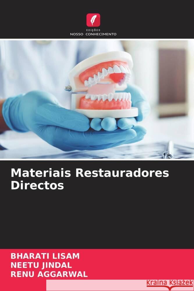 Materiais Restauradores Directos LISAM, BHARATI, Jindal, Neetu, Aggarwal, Renu 9786204691381 Edições Nosso Conhecimento - książka