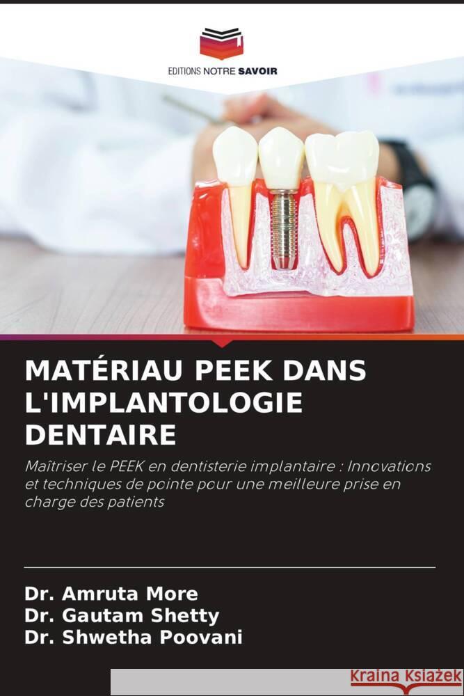 Mat?riau Peek Dans l'Implantologie Dentaire Amruta More Gautam Shetty Shwetha Poovani 9786208329341 Editions Notre Savoir - książka