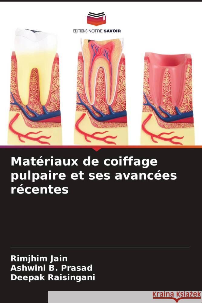 Matériaux de coiffage pulpaire et ses avancées récentes Jain, Rimjhim, B. Prasad, Ashwini, Raisingani, Deepak 9786205594438 Editions Notre Savoir - książka