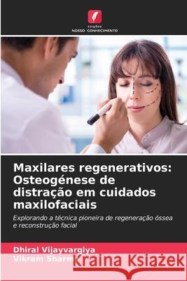 Maxilares regenerativos: Osteog?nese de distra??o em cuidados maxilofaciais Dhiral Vijayvargiya Vikram Sharma 9786207547333 Edicoes Nosso Conhecimento - książka