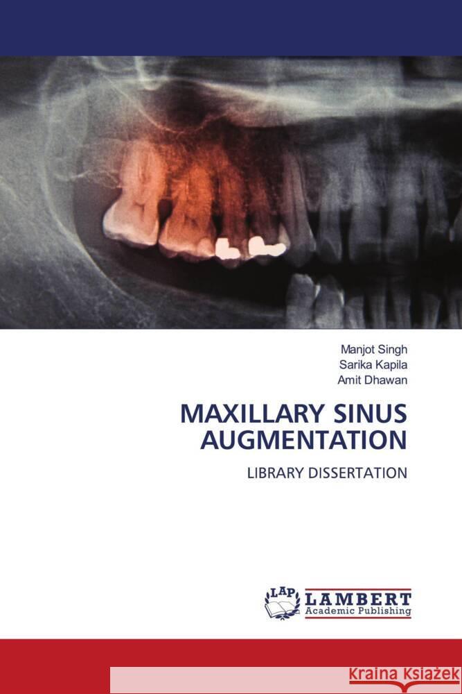 MAXILLARY SINUS AUGMENTATION Singh, Manjot, Kapila, Sarika, Dhawan, Amit 9786206181330 LAP Lambert Academic Publishing - książka