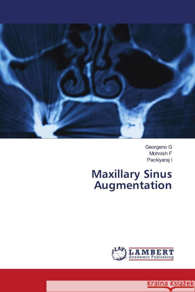 Maxillary Sinus Augmentation G, Georgeno, F, Mohnish, I, Packiyaraj 9786206791027 LAP Lambert Academic Publishing - książka