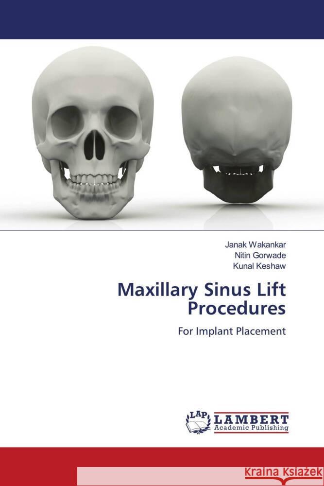 Maxillary Sinus Lift Procedures Wakankar, Janak, Gorwade, Nitin, Keshaw, Kunal 9786204979946 LAP Lambert Academic Publishing - książka