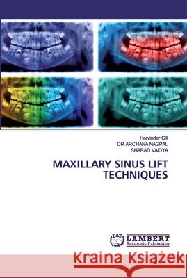 Maxillary Sinus Lift Techniques Gill, Harvinder 9786202524070 LAP Lambert Academic Publishing - książka