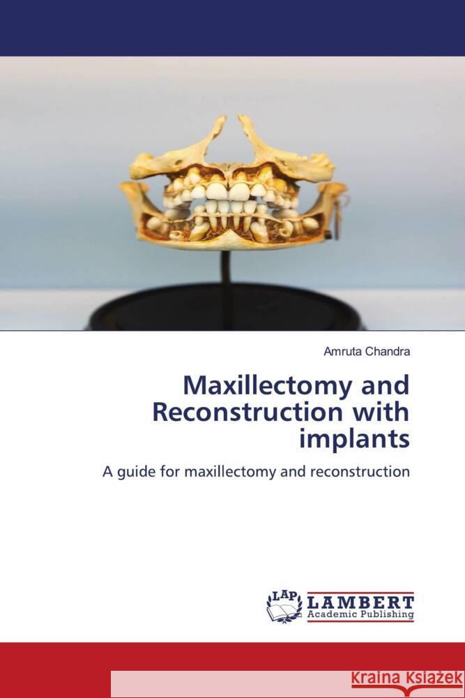 Maxillectomy and Reconstruction with implants Chandra, Amruta 9786208225292 LAP Lambert Academic Publishing - książka