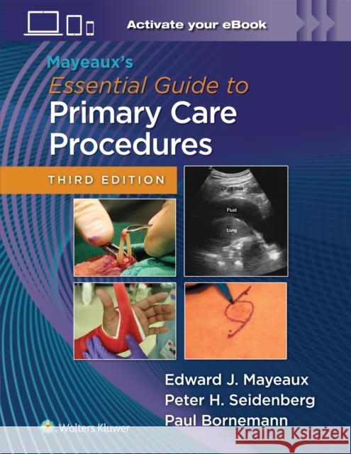 Mayeaux's Essential Guide to Primary Care Procedures: Print + eBook with Multimedia Edward John Mayeaux Paul Bornemann Peter H. Seidenberg 9781975221324 LWW - książka