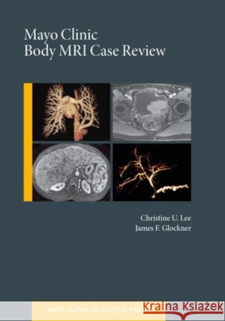 Mayo Clinic Body MRI Case Review Christine U. Lee James F. Glockner  9780199915705 Oxford University Press Inc - książka