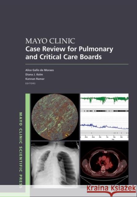 Mayo Clinic Case Review for Pulmonary and Critical Care Boards Gallo de Moraes 9780197755877 Oxford University Press - książka