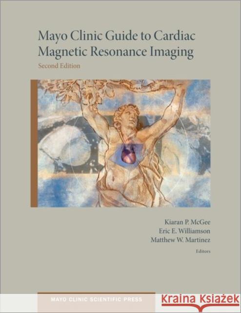 Mayo Clinic Guide to Cardiac Magnetic Resonance Imaging Kiaran McGee Matthew Martinez Eric Williamson 9780199941186 Oxford University Press, USA - książka