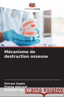 Mécanisme de destruction osseuse Gupta, Shivani, Agarwal, Prerna, Agarwal, Ashutosh 9786202453004 Editions Notre Savoir - książka