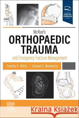 McRae\'s Orthopaedic Trauma and Emergency Fracture Management Timothy O. White Sam P. MacKenzie 9780323846820 Elsevier - książka