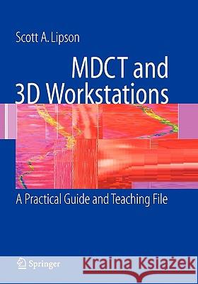 Mdct and 3D Workstations: A Practical How-To Guide and Teaching File Lipson, Scott A. 9781441920669 Not Avail - książka
