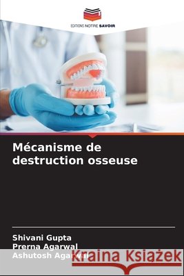 Mécanisme de destruction osseuse Gupta, Shivani, Agarwal, Prerna, Agarwal, Ashutosh 9786202453004 Editions Notre Savoir - książka