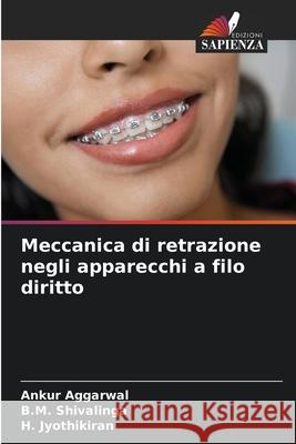 Meccanica di retrazione negli apparecchi a filo diritto Ankur Aggarwal B. M. Shivalinga H. Jyothikiran 9786202220583 Edizioni Sapienza - książka