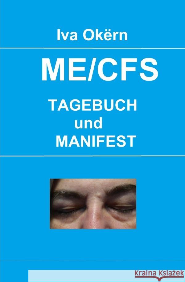 MECFS Okërn, Iva 9783819021756 epubli - książka