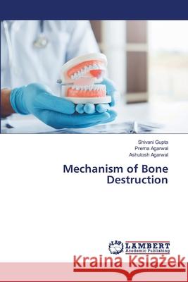 Mechanism of Bone Destruction Gupta, Shivani, Agarwal, Prerna, Agarwal, Ashutosh 9786208445232 LAP Lambert Academic Publishing - książka