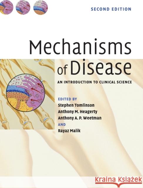 Mechanisms of Disease Tomlinson, Stephen 9780521818582 Cambridge University Press - książka