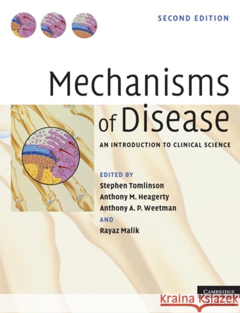 Mechanisms of Disease: An Introduction to Clinical Science Tomlinson, Stephen 9780521523189 CAMBRIDGE UNIVERSITY PRESS - książka