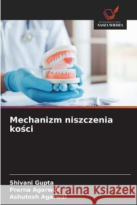 Mechanizm niszczenia kosci Gupta, Shivani, Agarwal, Prerna, Agarwal, Ashutosh 9786202453028 Wydawnictwo Nasza Wiedza - książka