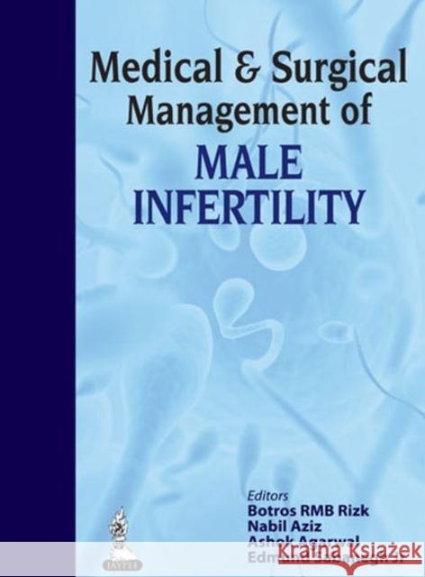Medical & Surgical Management of Male Infertility Botros R M B Rizk 9789350259467  - książka
