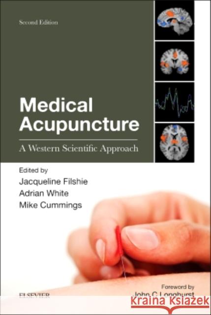 Medical Acupuncture: A Western Scientific Approach Jacqueline Filshie Adrian White Mike Cummings 9780702043079 Elsevier Health Sciences - książka