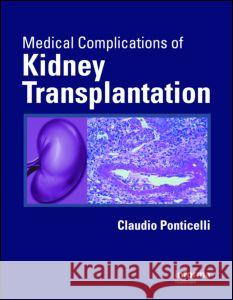 Medical Complications of Kidney Transplantation Claudio Ponticelli 9780415417150 Informa Healthcare - książka