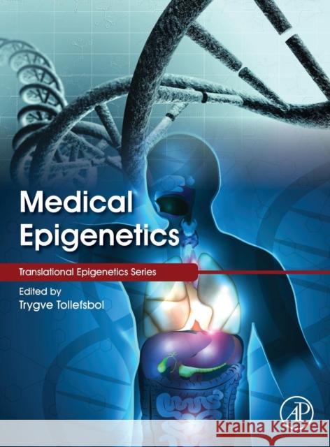 Medical Epigenetics Trygve Tollefsbol 9780128032398 ACADEMIC PRESS - książka