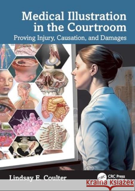 Medical Illustration in the Courtroom: Proving Injury, Causation, and Damages Lindsay E. Coulter 9781032372945 Taylor & Francis Ltd - książka