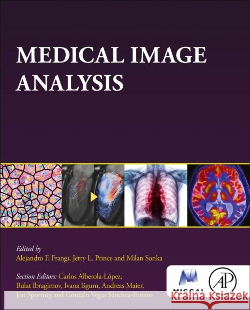 Medical Image Analysis Alejandro F. Frangi Jerry L. Prince Milan Sonka 9780128136577 Academic Press - książka