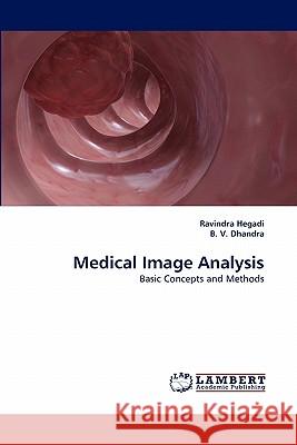 Medical Image Analysis Ravindra Hegadi, B V Dhandra 9783843358354 LAP Lambert Academic Publishing - książka