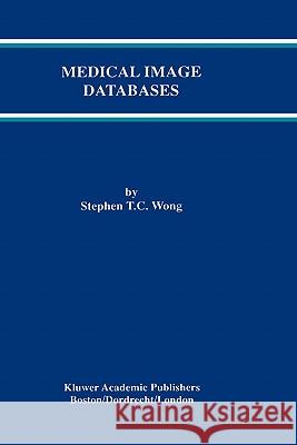 Medical Image Databases Stephen T. Wong Stephen T. C. Wong 9780792382898 Kluwer Academic Publishers - książka