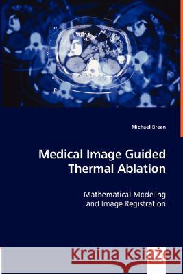 Medical Image Guided Thermal Ablation Michael Breen 9783836468800 VDM Verlag - książka