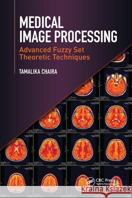 Medical Image Processing: Advanced Fuzzy Set Theoretic Techniques Tamalika Chaira 9780367575960 CRC Press - książka