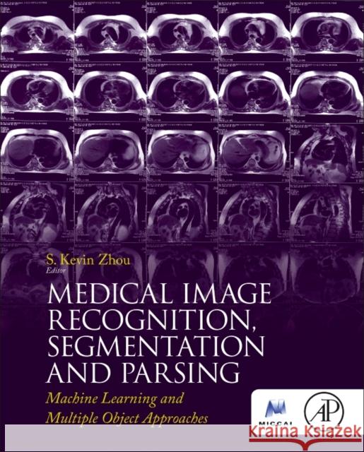 Medical Image Recognition, Segmentation and Parsing: Machine Learning and Multiple Object Approaches Zhou, Kevin   9780128025819 Elsevier Science - książka