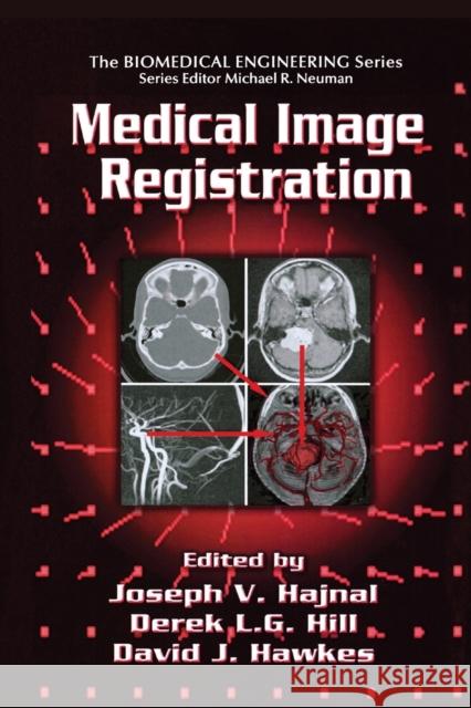 Medical Image Registration Joseph V. Hajnal Derek L. G. Hill 9780367397203 CRC Press - książka