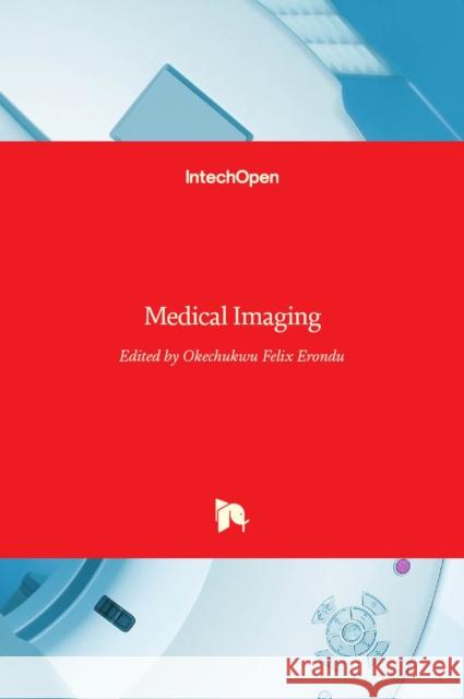 Medical Imaging Okechukwu Felix Erondu 9789533077741 Intechopen - książka