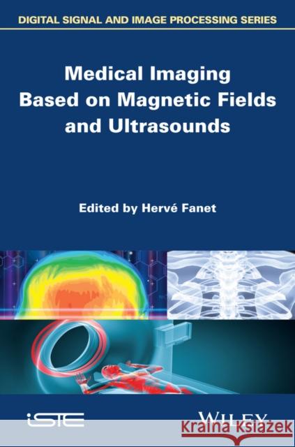 Medical Imaging Based on Magnetic Fields and Ultrasounds Herv? Fanet 9781848215023 Wiley-Iste - książka